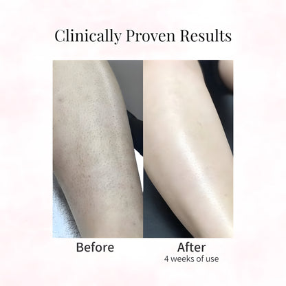 Cyperus Rotundus Oil for Hair Removal