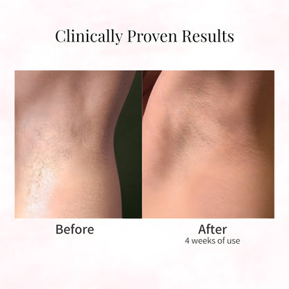 Cyperus Rotundus Oil for Hair Removal