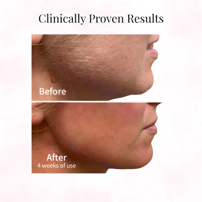 Cyperus Rotundus Oil for Hair Removal