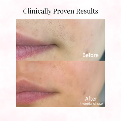 Cyperus Rotundus Oil for Hair Removal