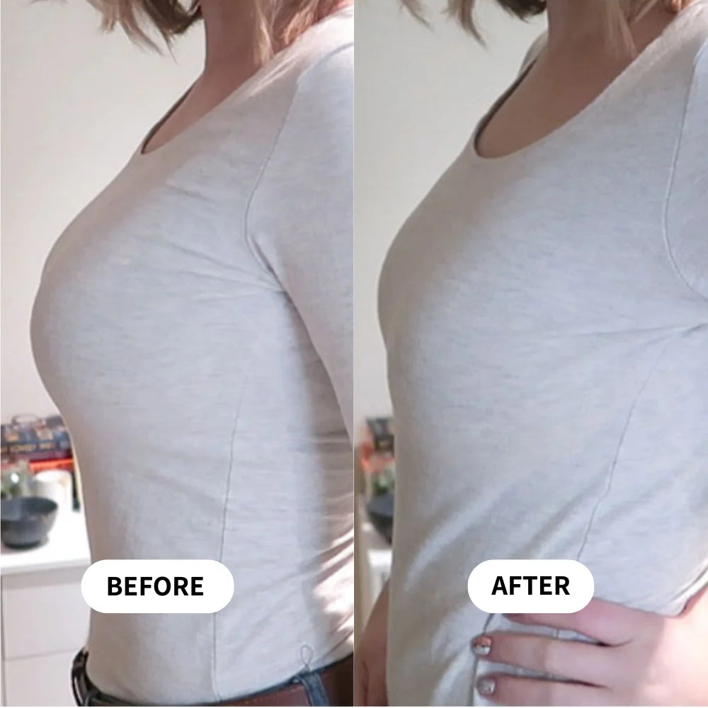Breast Minimizer Bra