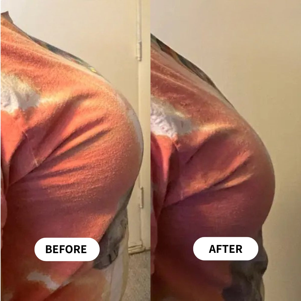 Breast Minimizer Bra