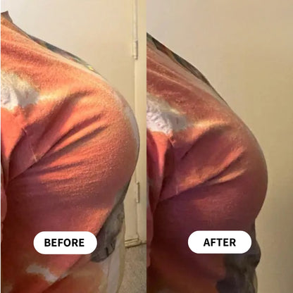 Breast Minimizer Bra
