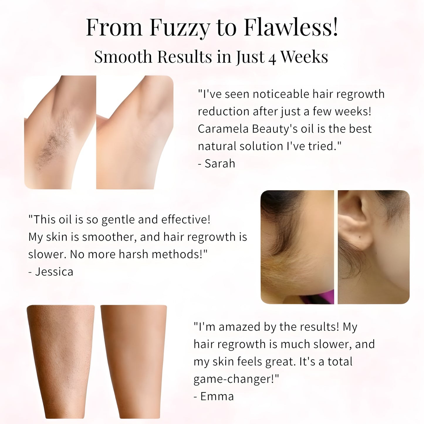 Cyperus Rotundus Oil for Hair Removal